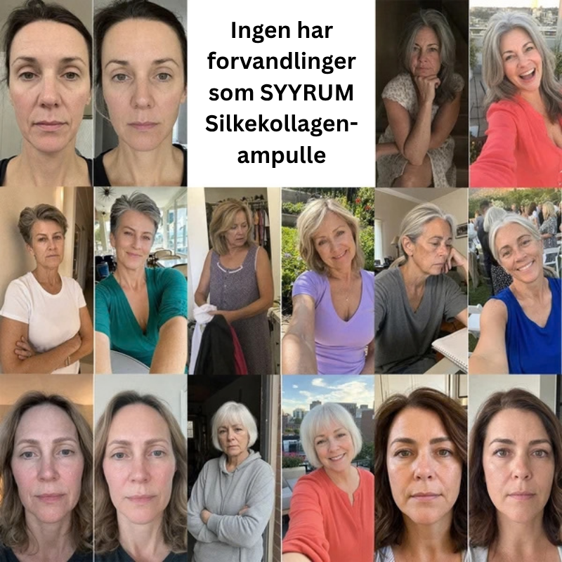 Kundenes før- og etterbilder med SYYRUM